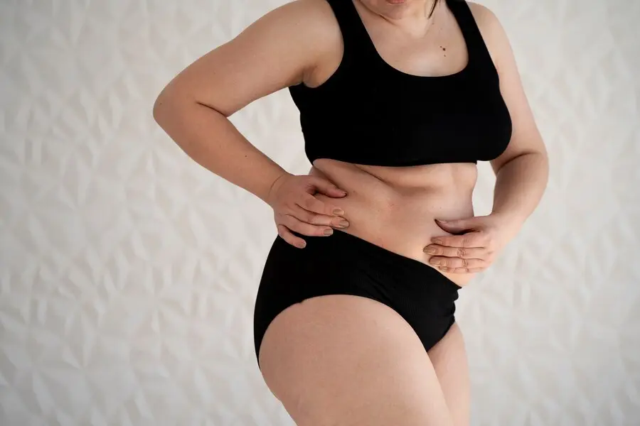 Fat, Begone! 9 Surprising Liposuction Facts
