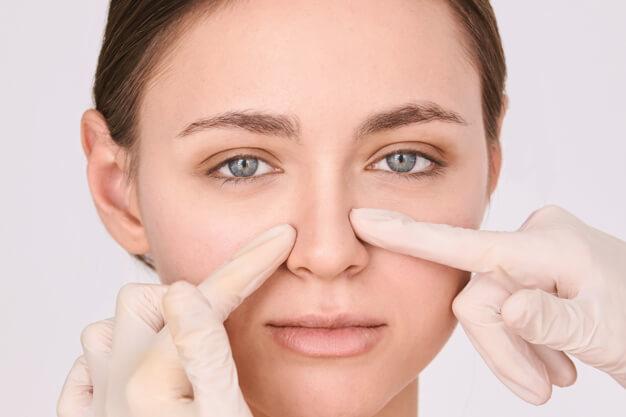 Cosmetic surgeon points Aesthetic & Functional imperfections in woman's nose that can be corrected using Rhinoplasty for easier breathing and better looks.