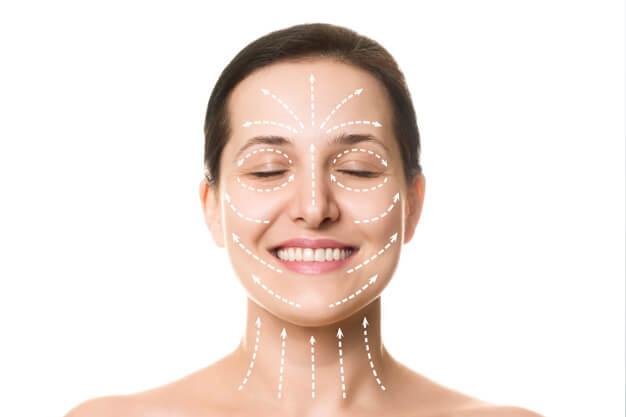 Woman's face with pre-treatment markings showing the facial areas where Thermage Skin Tightening Procedure will be performed.