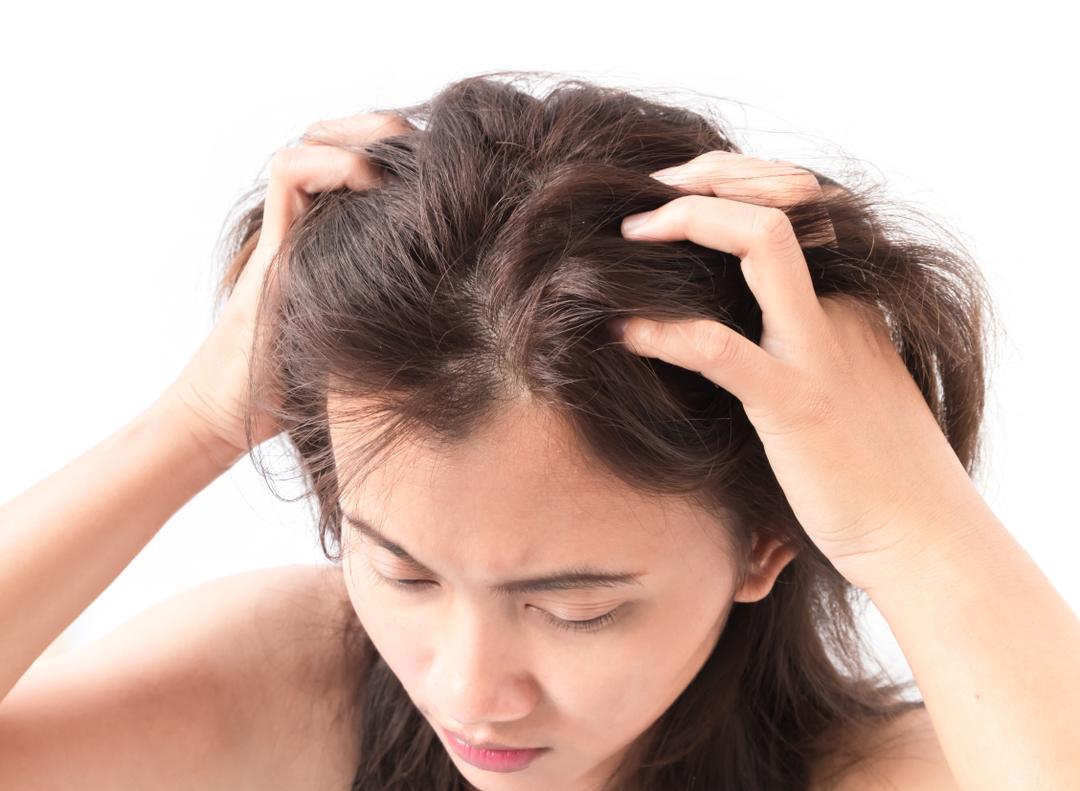Itching in the Scalp or Lice/Nits in the Scalp