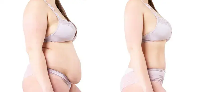 Mommy Makeover - Combination of breast lift/ breast lift with augmentation/ breast reduction, lipo abdominoplasty, 360 degree high def liposuction - Before & After