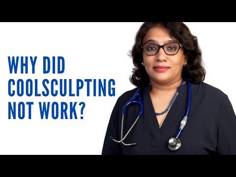 Coolsculpting - Before & After