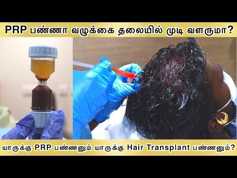 PRP Treatment - Before & After