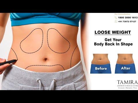 Lipo Abdominoplasty - Before & After